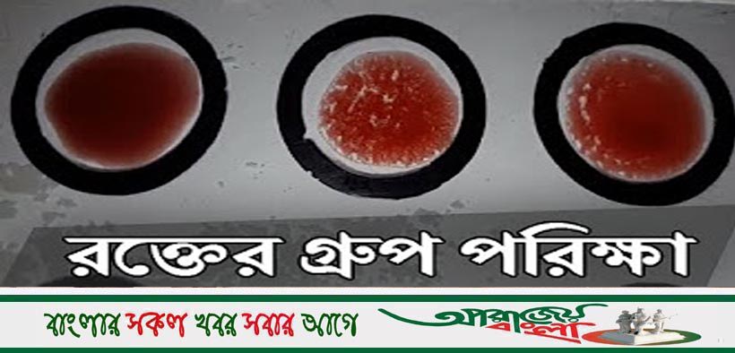চৌগাছায় ফ্রি ডায়াবেটিস পরীক্ষা ও রক্তের গ্রুপ নির্ণয়
