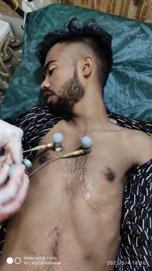 চৌগাছা মোটরসাইকেল দুর্ঘটনায় দুইজন নিহত