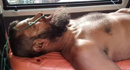 নড়াইলের লোহাগড়ায় সড়ক দূর্ঘটনায় শিক্ষকসহ আহত ৩