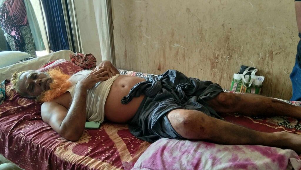 নড়াইলে সহকারী ভূমি কর্মকর্তা কে হাতড়ি দিয়ে পিটিয়ে জখম