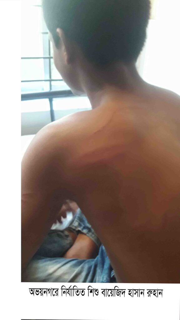 অভয়নগরে নির্যাতনের পর মেধাবী শিশুর বিরুদ্ধে ছিনতাই মামলার জন্য থানায় অভিযোগ দায়ের