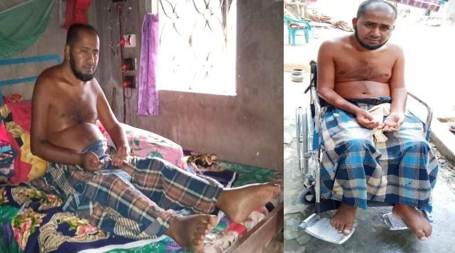 সোহেল রানার অসহায় জীবনযাপন; বিত্তবানদের পাশে দাঁড়ানোর আহ্বান