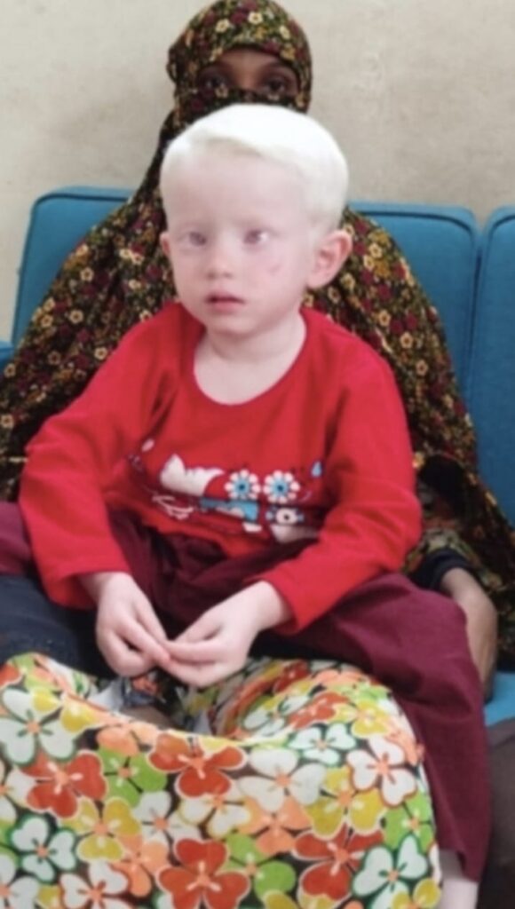 যশোরে শ্বেতফর্সা আফিয়ার ডিএনএ পরীক্ষা চেয়ে আদালতে আবেদন